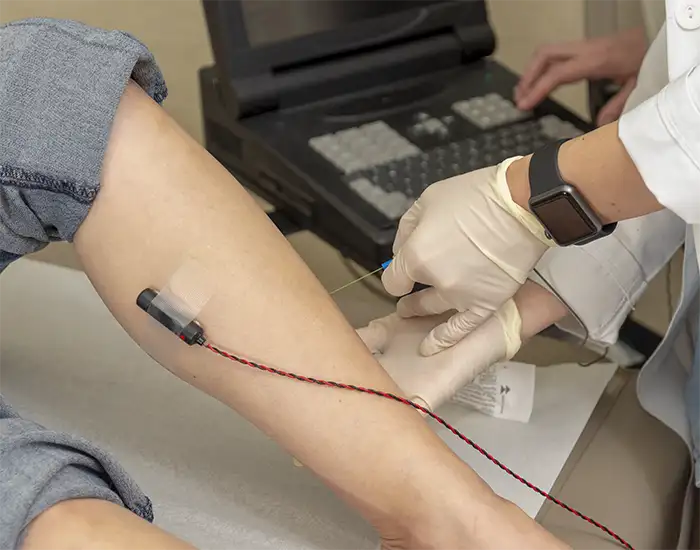 An electromyography test being performed on a leg. A computer that records the results is seen in the background.