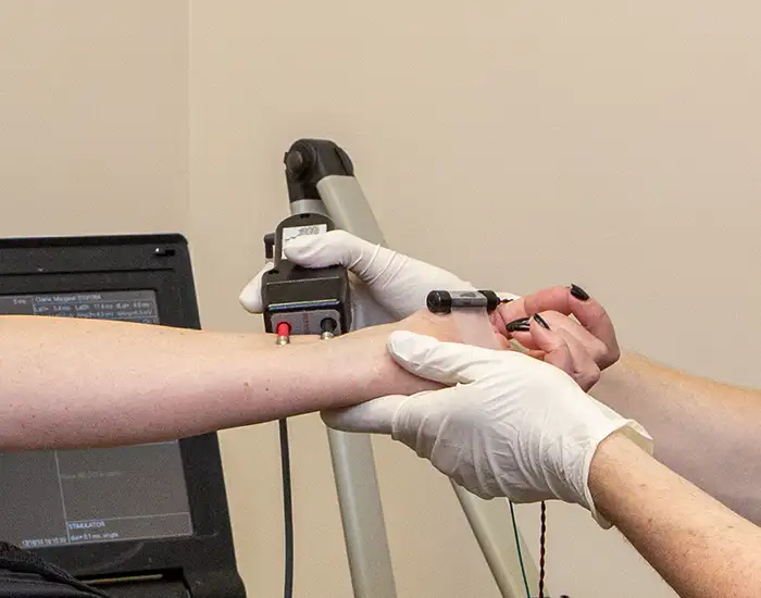 A nerve conduction study being done on the wrist of a patient